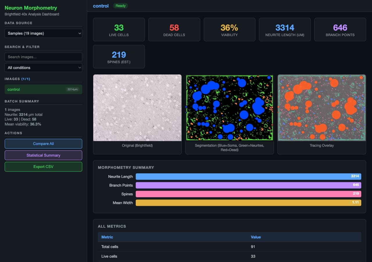 Neuron morphometry dashboard: live/dead cell counts, viability, neurite length, and a brightfield / segmentation / tracing overlay.